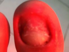 -新甲连锁灰指甲·甲沟炎·鸡眼(黑龙江路店)