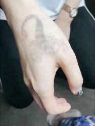 -天道专业洗纹身