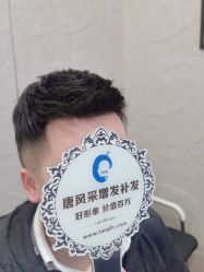 -唐风采假发补发定制