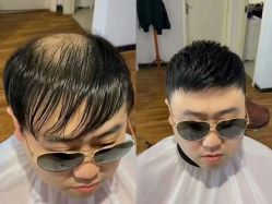 -发饰美男士增发补发假发定制店