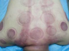 -张钰强中医正骨推拿连锁(唐家人才公寓店)