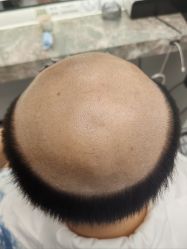 -唐风采假发补发定制