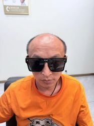 点击看大图 -唐风采假发补发定制