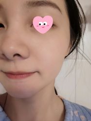 点击看大图 体验后-Yestar 嘉兴艺星医疗美容医院