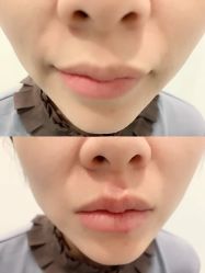 -悦己医疗美容整形线雕提升专门店