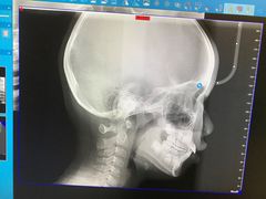 -泰康拜博口腔医院(海曙店)
