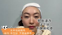 体验前-上海漾颜医疗美容