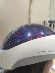 -碧莲盛·不剃发植发