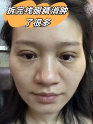 -素美医疗美容·西南眼鼻整形·修复基地