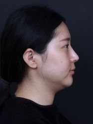 体验前-南宁华美医疗美容医院