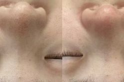 -SKIN79皮肤管理中心