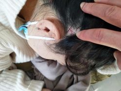 -北京美痣堂古方祛痣斑疣瘊