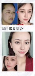 -Yestar艺星医疗美容医院