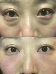 -兰派国际美容养生SPA