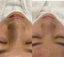 -蕾特恩专业祛痘·皮肤管理