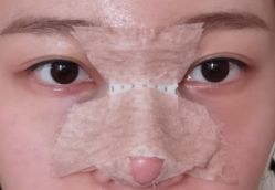 -成都西区医院整形美容