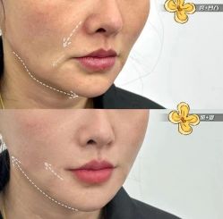 -LUNA皮相美·骨相美高级美感