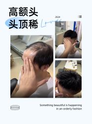 -唐风采假发补发定制