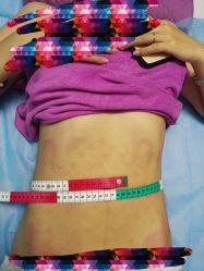 -清媚减肥瘦身纤体