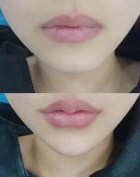 -上海漾颜医疗美容