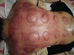 -益友堂盲人推拿正骨穴位按摩工作室