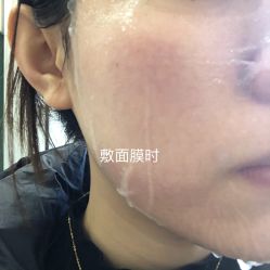 体验后-和颜一美轻医美连锁