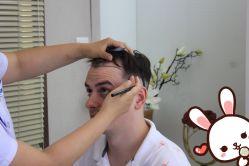 -大麦微针植发丨全国连锁