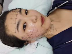 体验前-Dr.U博士医疗美容医院
