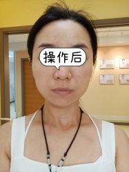 体验后-北京爱育华医院-医疗美容科