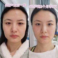 -郑州米兰柏羽集美医疗美容医院