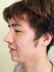 -青岛诺德医学美容医院