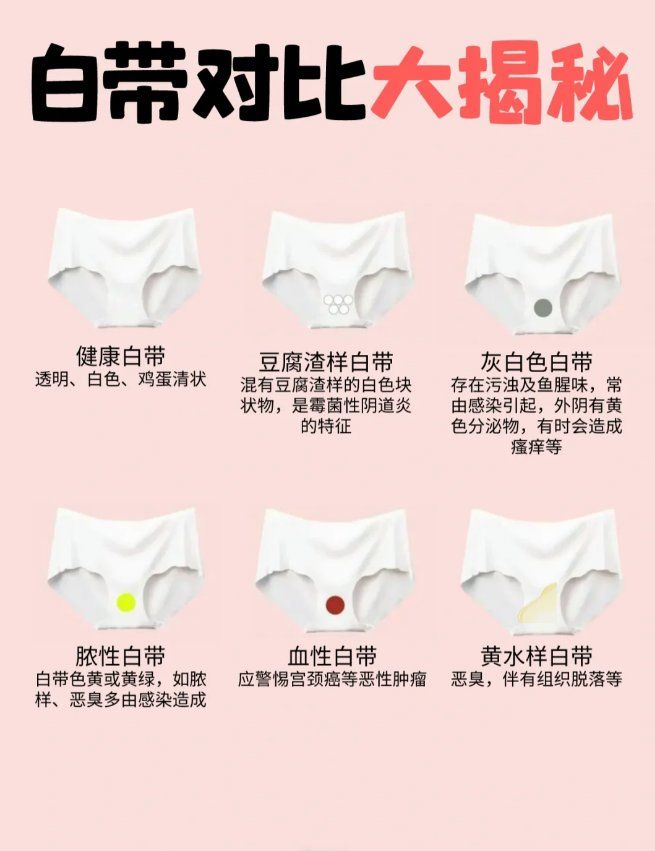 白带是78无气味,微酸性的粘稠物,具有湿润阴道,排泄废物,抑制病原菌