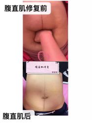 -玛丽亚妇产医院产后修复·医美产康中心