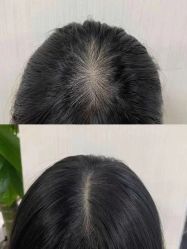 -希梵尔头皮抗衰·科技养发