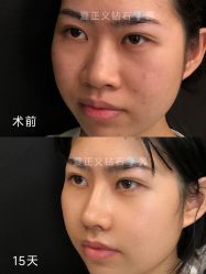 -北京米扬丽格医疗美容·联合丽格鼻整形中心