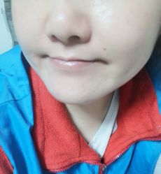 -皙塑美肤·spa