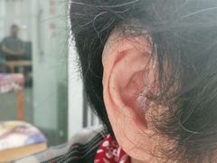 -宁耳听力助听器奥迪康·峰力·西门子(宝山店)