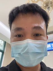 -大麦微针植发丨全国连锁