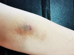 -上海中医药大学附属曙光医院(东部)