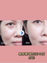 -厦门美莱整形美容医院