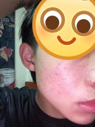 点击看大图 体验前-铂特丽医美·眼鼻整形·光电美肤·注射抗衰