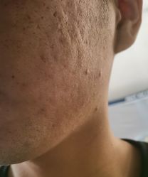 -丽美妍医疗美容·皮秒·立体分层抗衰