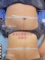 点击看大图 -蓝丝带催乳产康产后恢复中心(殷巷店)