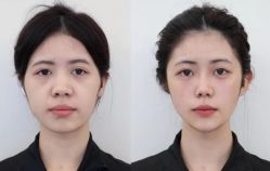 点击看大图 -Yestar艺星医疗美容医院