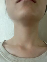 -Yestar宁波艺星整形医院