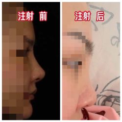 点击看大图 -青岛诺德医学美容医院