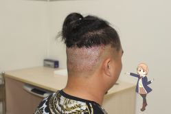 -大麦微针植发丨全国连锁