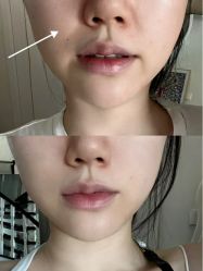 -四川米兰柏羽医学美容医院