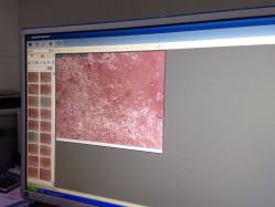 点击看大图 iphone_upload_pic-MedSkinCare科技祛痘肌肤修护中心