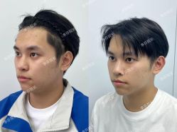 -杭州米兰柏羽医疗美容医院